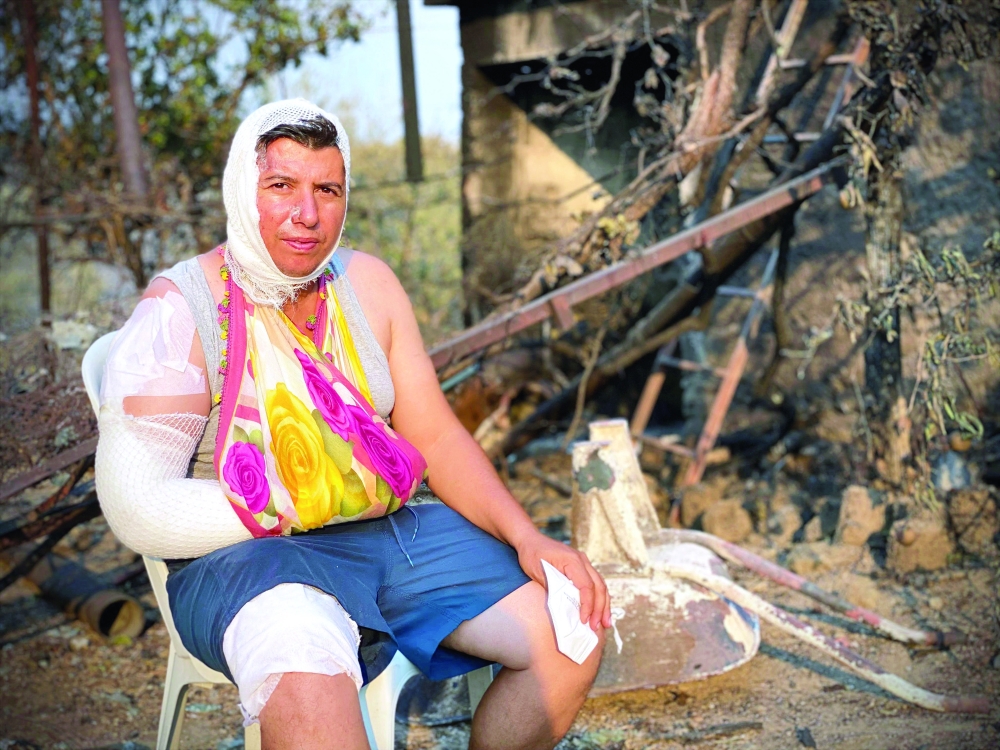 An injured person sits in front of a burnt house near the town of Manavgat, Turkey. - AFP