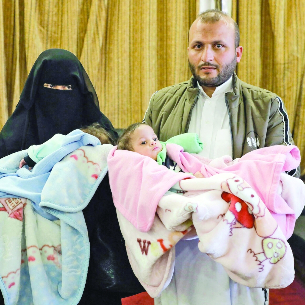 The twins were separated in July at Amman's Speciality Hospital in a nearly eight-hour operation involving 25 surgeons and technical advisers.