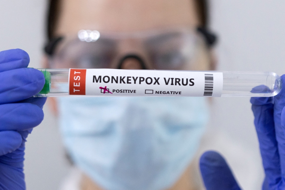 Test tubes labelled 'Monkeypox virus positive' are seen in this illustration. - Reuters