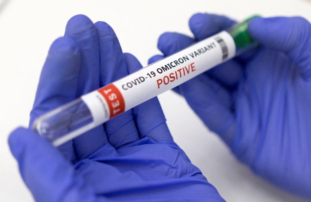 Test tube labelled 'Covid-19 Omicron variant test positive' is seen in this illustration picture. - Reuters