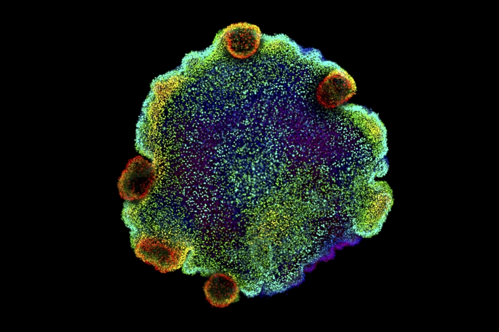 In an undated image from Sebastian R. Najle/Center for Genomic Regulation, a placozoan with fluorescent staining to show different cell types and proteins. (Sebastian R. Najle/Center for Genomic Regulation via The New York Times)