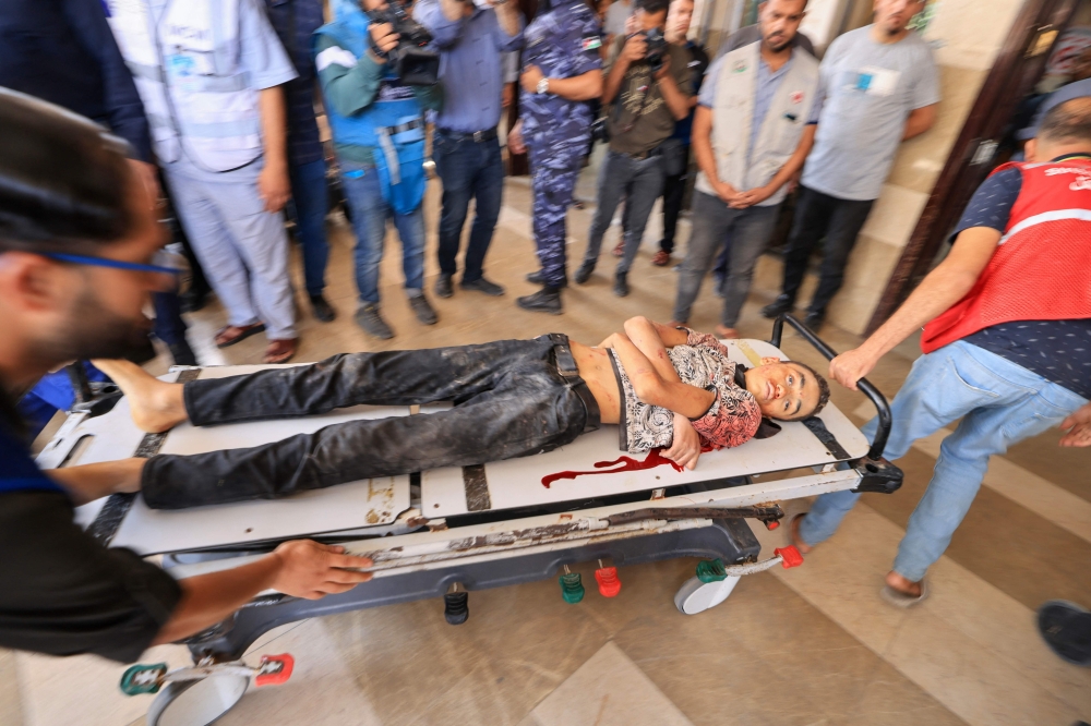 An child injured during Israeli air strikes is wheeled into the hospital in Khan Yunis in the southern of Gaza Strip, on October 16, 2023. 