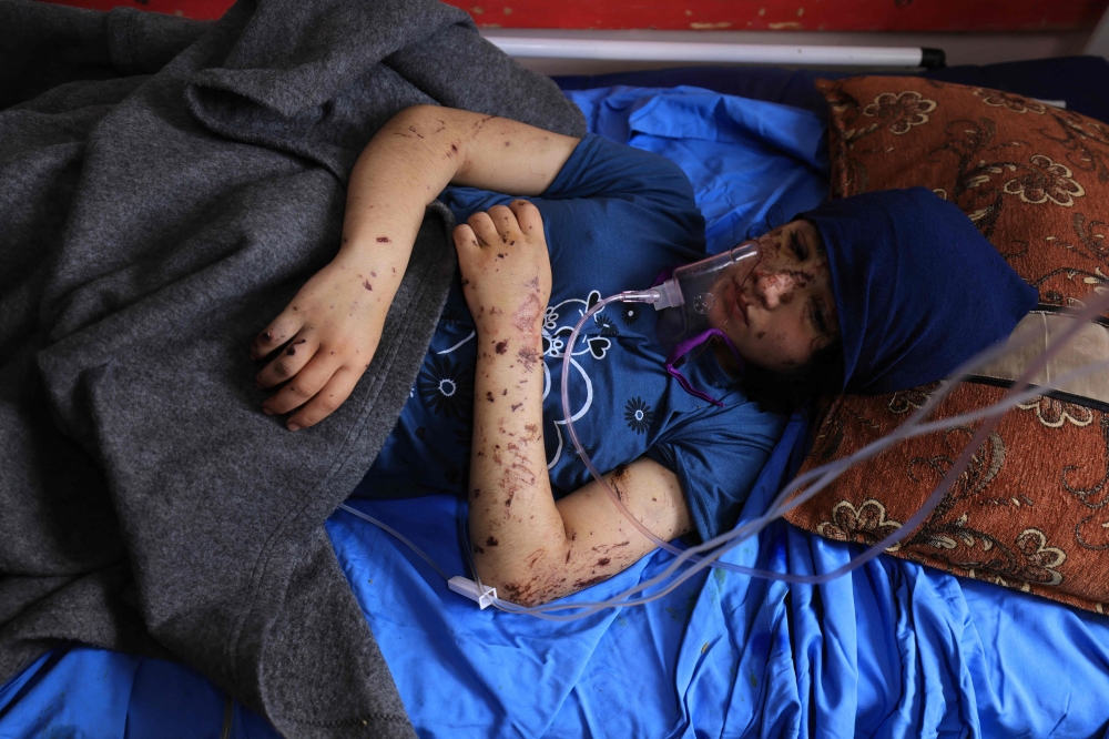 Amputee Layan al Baz, aged 13, receives treatment at the Nasser hospital in Khan Yunis in the southern Gaza Strip. - AFP 