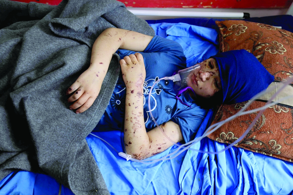 Amputee Layan al Baz, aged 13, receives treatment at the Nasser hospital in Khan Yunis in the southern Gaza Strip. - AFP 
