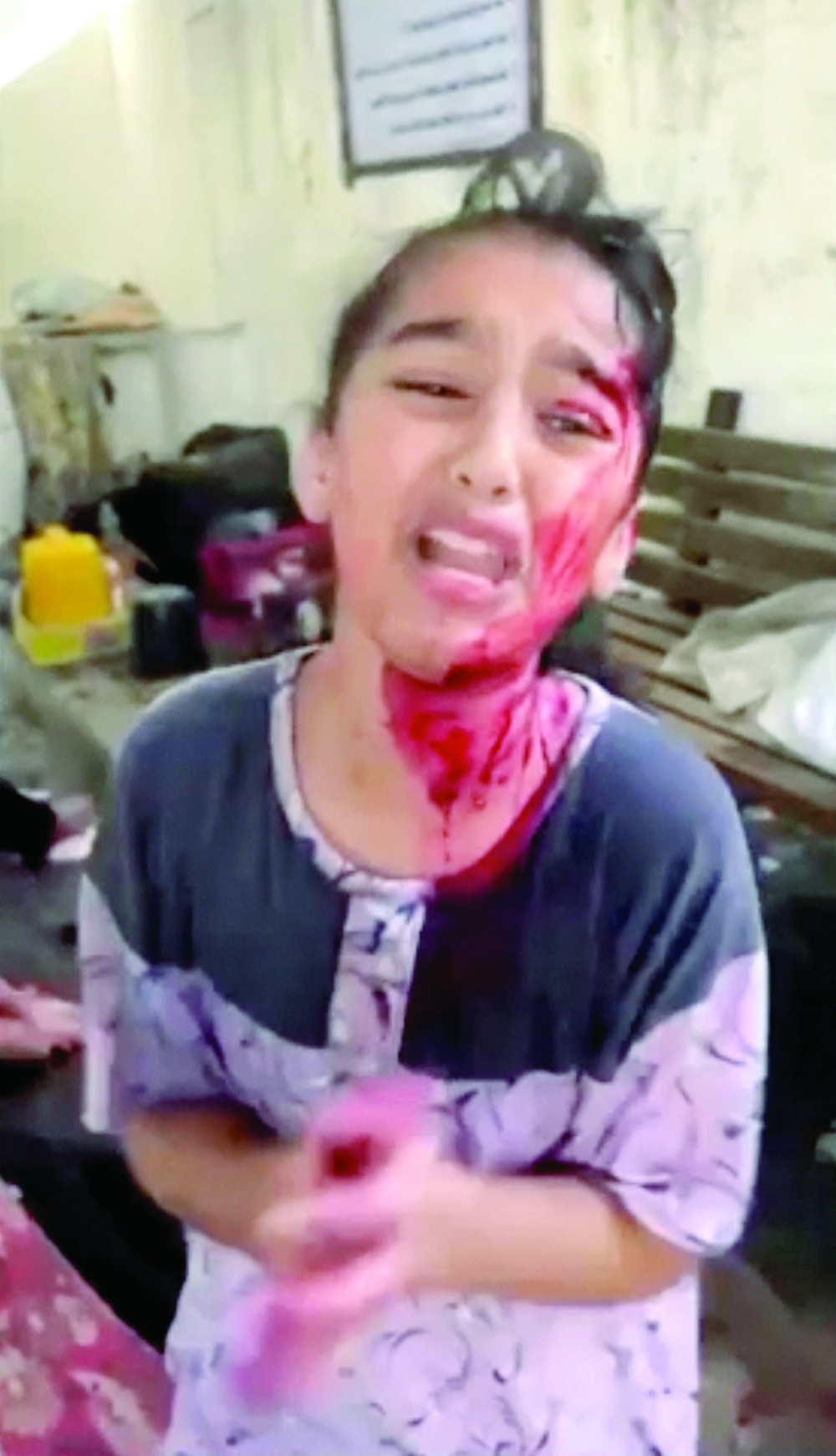 A Palestinian girl cries at the outpatient clinic of Al Shifa Hospital, following an Israeli strike, in Gaza City