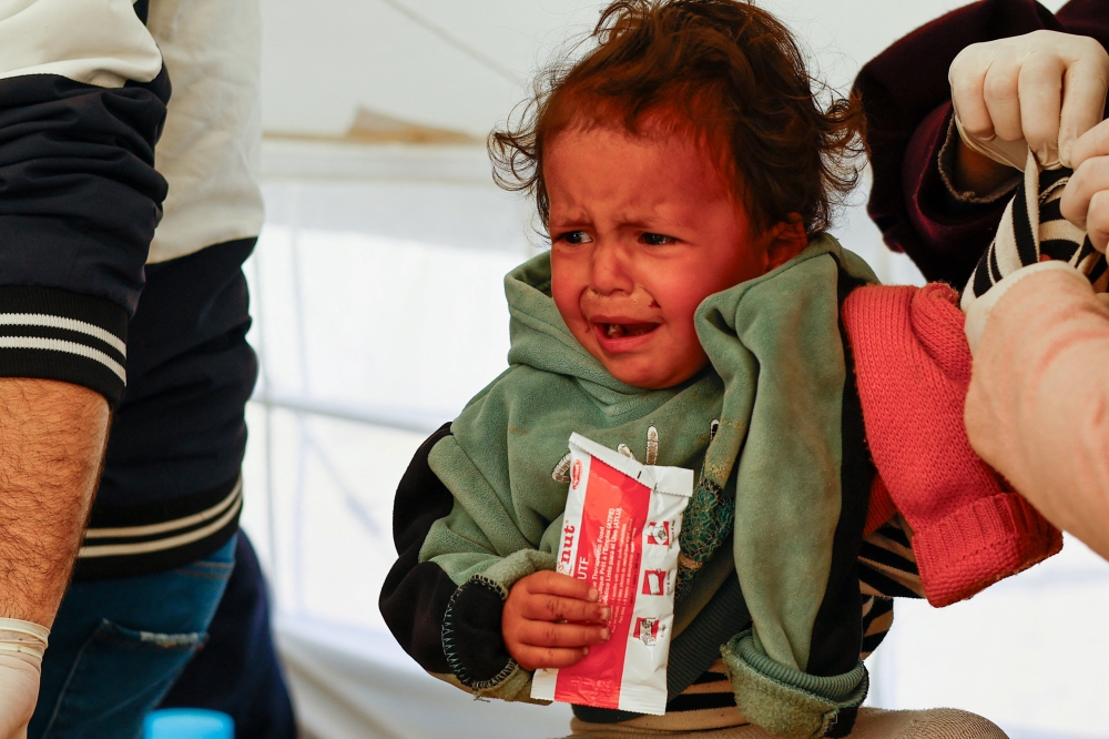 A Palestinian girl is checked for malnutrition at a medical tent set up by MedGlobal in cooperation with UNICEF