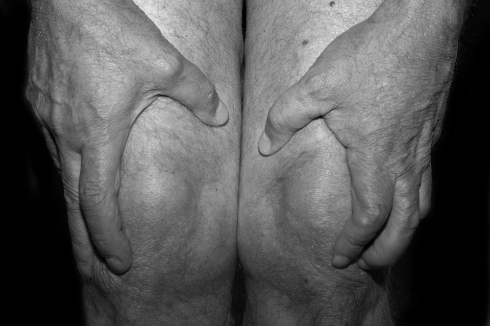 Scientists are racing to find ways to diagnose osteoarthritis earlier and stave off or slow some of the damage from the disease, which affects over 32.5 million adults in the United States and more than 500 million people worldwide. (Patricia Voulgaris/Th