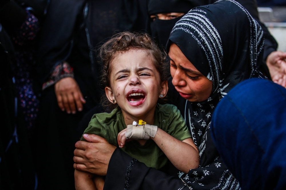An injured girl is comforted by her relatives at the Aqsa Martyrs Hospital in Deir el-Balah