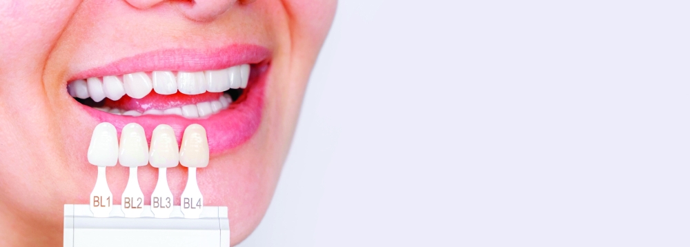 True colours of teeth are beyond white and bright