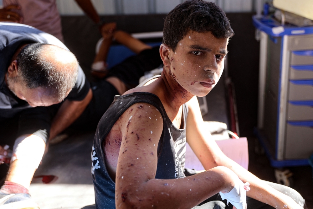 An injured Palestinian boy awaits treatment for his burns and wounds at the al-Maamadani hospital