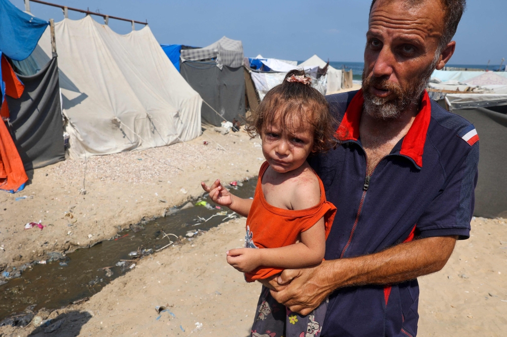 A man holds a child suffering from a rash next to raw sewage at a makeshift camp  