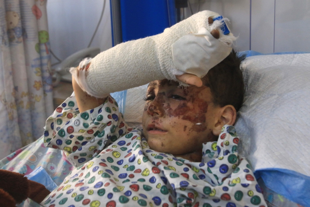 Wounded Lebanese child Haidar Hijazi rests at hospital in Sidon after he was injured following an Israeli airstrike  