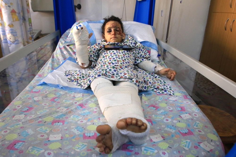Wounded Lebanese child Haidar Hijazi 5, rests at hospital in Sidon