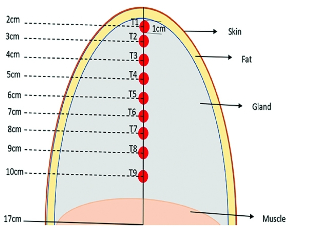 The objective is to enhance breast cancer detection accuracy by analysing temperature variations influenced by tumour properties and cooling techniques.