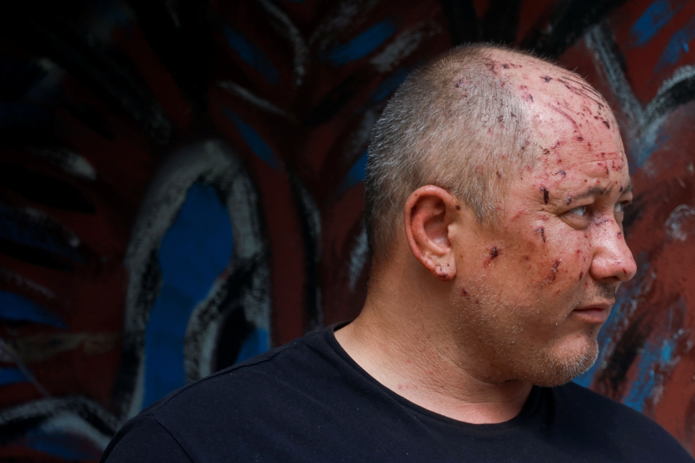 A man, who was injured during a Russian missile strike, appears at the site of his damaged house, amid Russia's attack on Ukraine, in Kyiv. - Reuters

