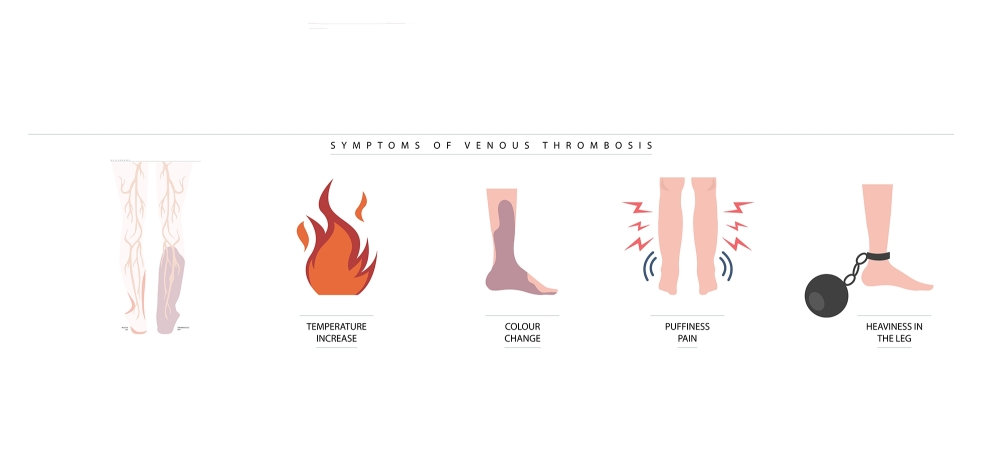 Venous Thrombosis: HIDDEN DANGER DURING LONG TRAVEL