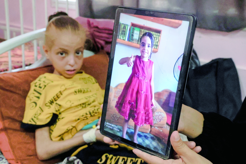 
Palestinian girl Huda Abu Al Naja lies on a bed receiving treatment at the malnutrition ward at Nasser hospital as her mother Sumayya shows an image of Huda when she was healthier, in Khan Younis, southern Gaza Strip. - Reuters 