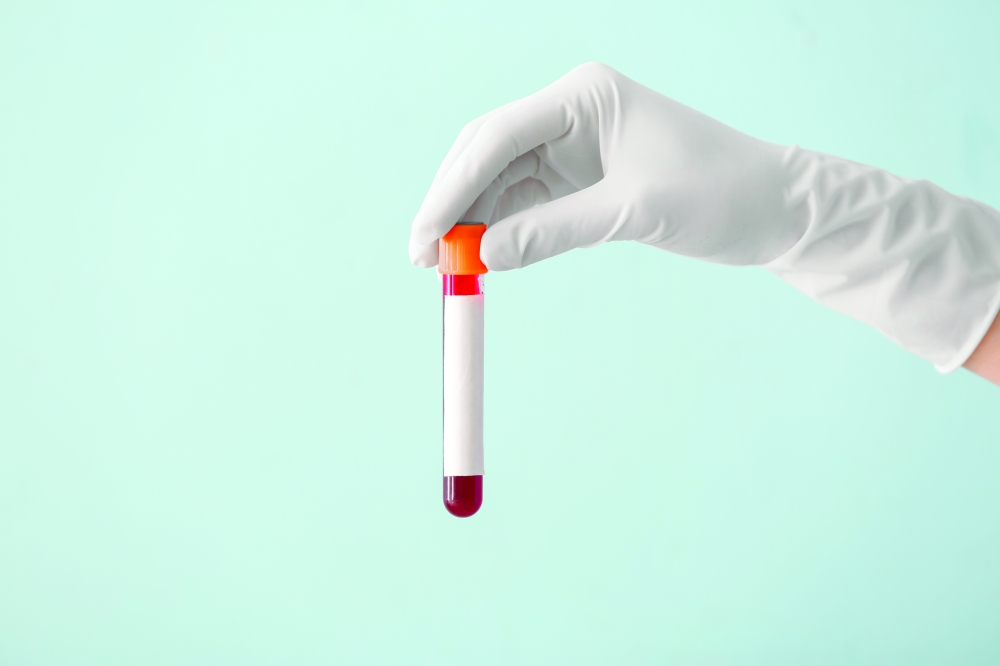 LEAD POISONING Hidden household danger