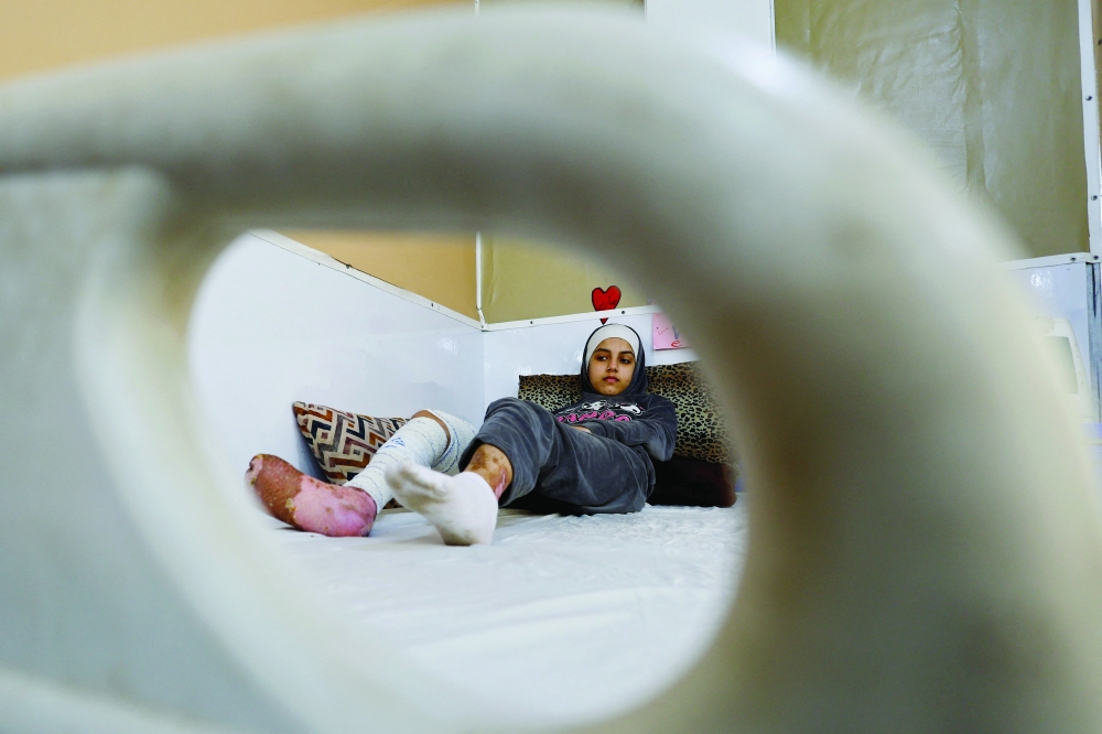 A Palestinian burn victim, Maria Abu Aawad, lies on a hospital bed at a Doctors Without Borders (MSF) hospital in Zawaida, in the central Gaza Strip. - Reuters file photo