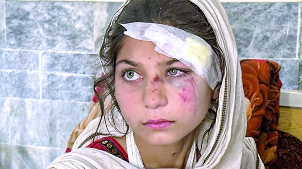 Call for ceasefire between Pakistan and Afghanistan