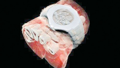 Scientists take first 3D, colour X-ray of a human - Oman Observer