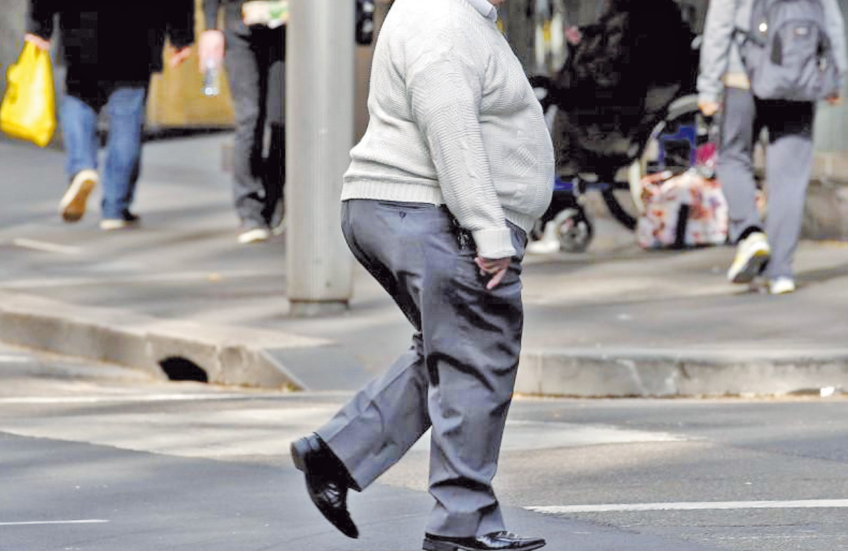 Type of weight loss surgery matters for people with severe obesity